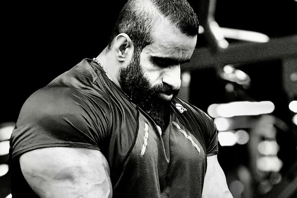 استایل جدید و عجیب هادی چوپان پس از کاشت مو/ عکس